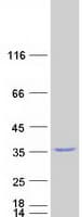 Human GNB2L1 / RACK1 Protein (Recombinant Myc-DDK (Flag))