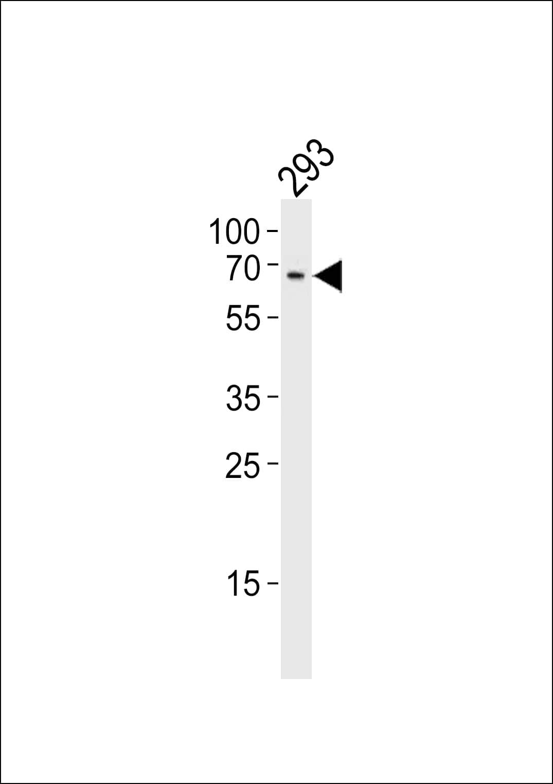 TESK1 Antibody (aa187-215)