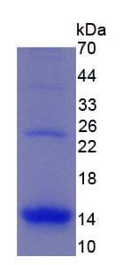 Human CCL3 / MIP-1-Alpha Protein (Recombinant His, N-Terminal)