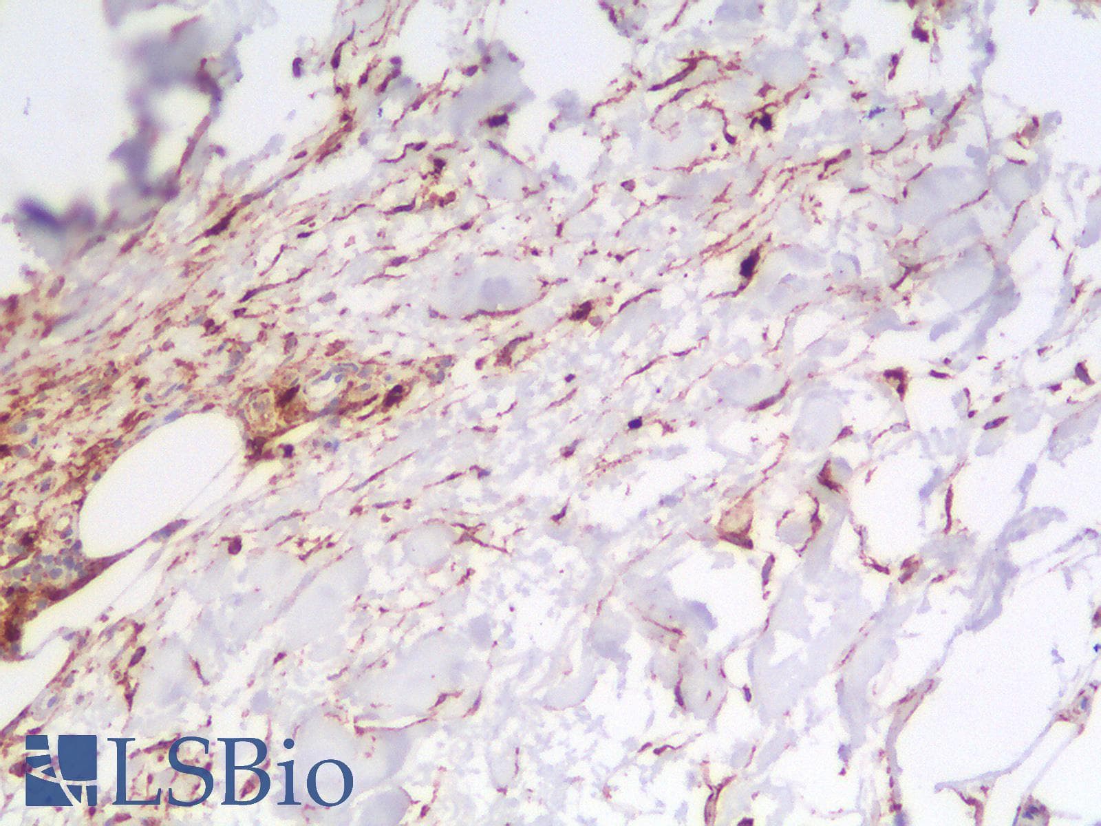 PathPlus™ CD63 Antibody (clone LAMP3/2990R)