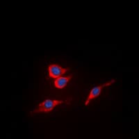 KDR / VEGFR2 / FLK1 Antibody (phospho-Tyr951)