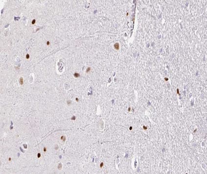 TOP2B / Topoisomerase II Beta Antibody