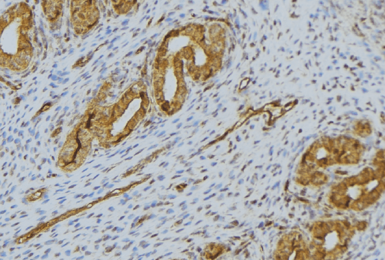 SPINK1 Antibody