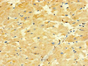 Polyclonal Rabbit anti-Human ORMDL2 Antibody