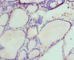 Polyclonal Rabbit anti-Human HAS3 Antibody (aa339-553, IHC)