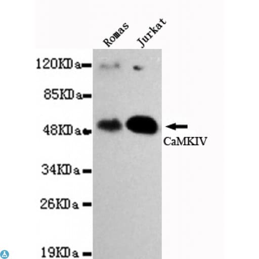 CAMK4 / CaMK IV Antibody
