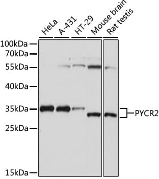 Polyclonal Rabbit anti-Human P5CR2 / PYCR2 Antibody (WB)