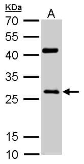 NQO1 Antibody (aa213-274)