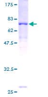 Human ACADL Protein (Recombinant GST)