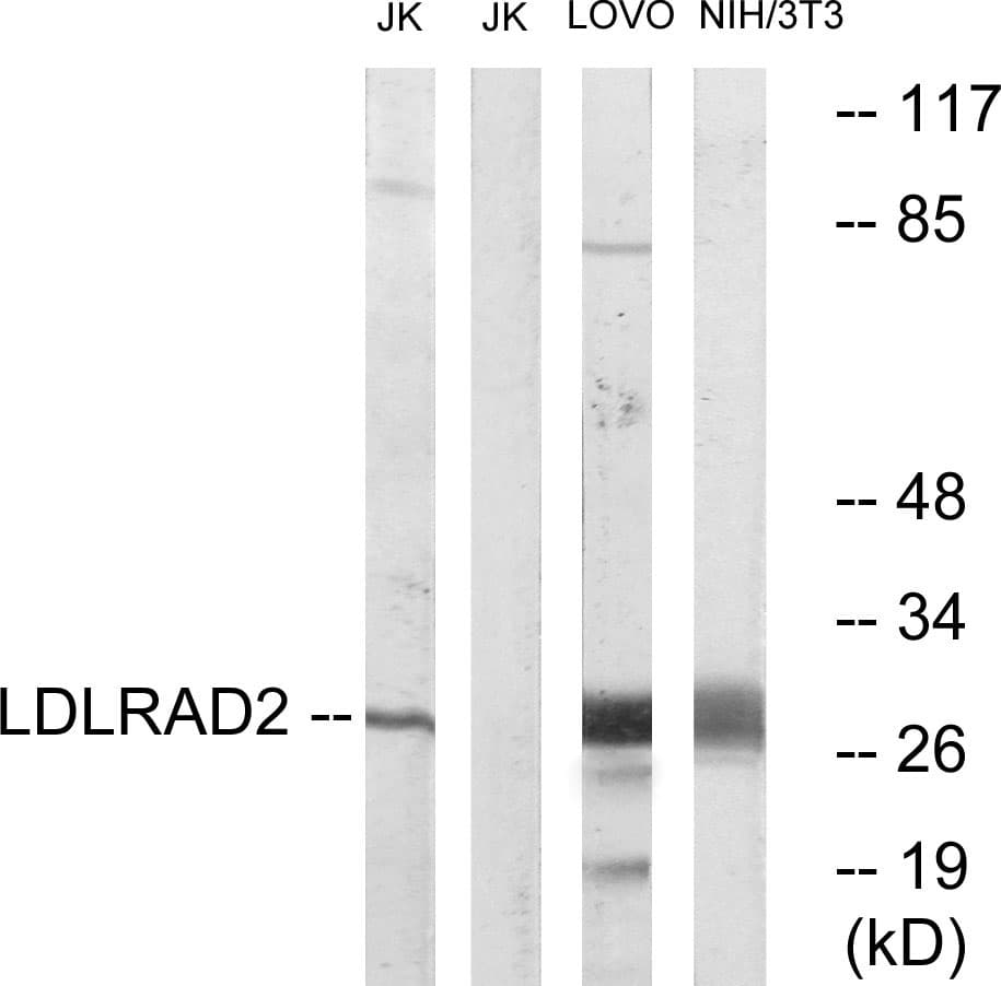 Polyclonal Rabbit anti-Human LDLRAD2 Antibody (aa130-179, WB)