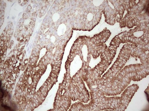 Monoclonal Mouse anti-Human ABCB1 / MDR1 / P Glycoprotein Antibody (clone OTI11D2, aa995-1280, IHC)