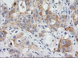 BAIAP2 / IRSP53 Antibody (clone OTI 1D9)