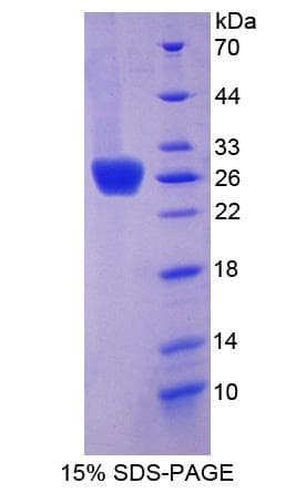 Mouse THSD7A Protein (Recombinant His-T7)