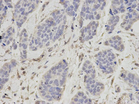 IHC-plus™ OGT / O-GLCNAC Antibody