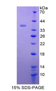 Human CX3CL1 / Fractalkine Protein (Recombinant His-T7)