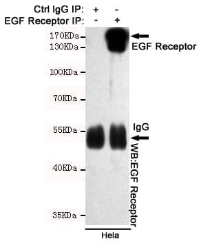 Monoclonal Mouse anti-Human EGFR Antibody (IHC, WB)