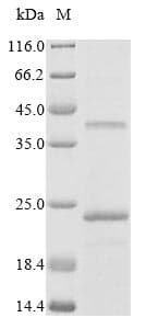 Rat PMP22 Protein (Recombinant 10His, N-terminus)