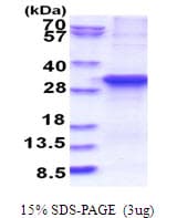 Human ASB13 Protein (Recombinant His)