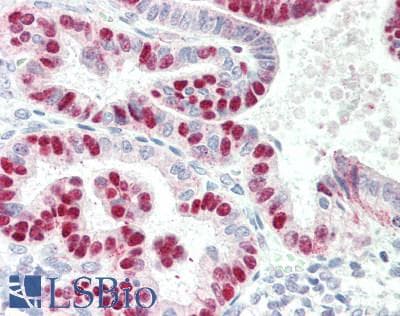 IHC-plus™ Polyclonal Rabbit anti-Human TFB1 / GTF2H1 Antibody (aa32-81, IHC, WB)