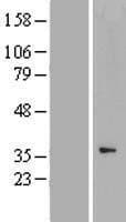 CCNYL1 Protein (Over-Expression Lysate Myc-DDK (Flag))
