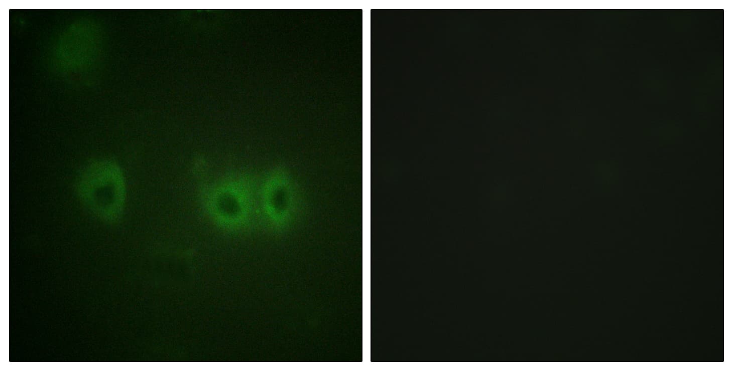IHC-plus™ MLC2 / MYL9 Antibody (aa3-52)