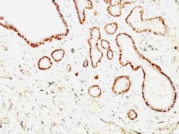 CNN1 / Calponin Antibody (clone CNN1/832 + CALP)