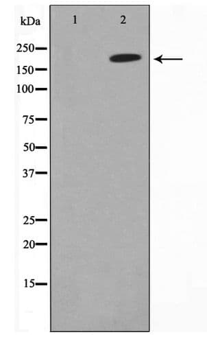 TOP2A / Topoisomerase II Alpha Antibody