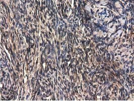 QPRT Antibody (clone OTI1C10, Carrier-free)