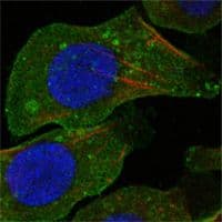 DDR2 Antibody (clone 3B11E4)