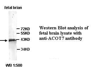 ACOT7 / BACH Antibody (C-Terminus)