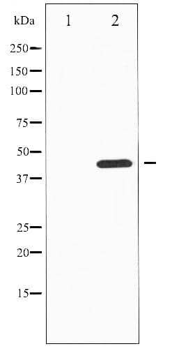 Polyclonal Rabbit anti-Human TH / Tyrosine Hydroxylase Antibody (phospho-Ser19, IHC, IF, WB)
