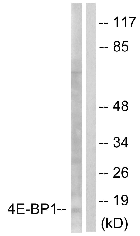 PathPlus™ EIF4EBP1 / 4EBP1 Antibody (aa30-79)