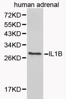 IL-1B / IL-1 Beta Antibody