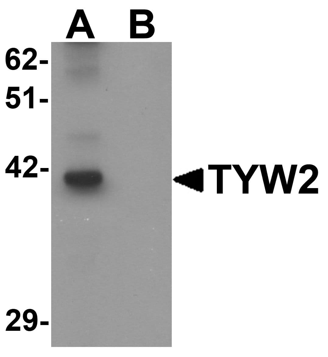 TYW2 / TRMT12 Antibody