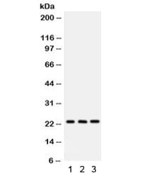 Polyclonal Rabbit anti-Human BAG2 Antibody (IHC, WB)