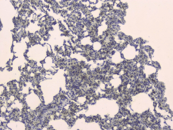 SLC34A2 / NaPi-2b Antibody