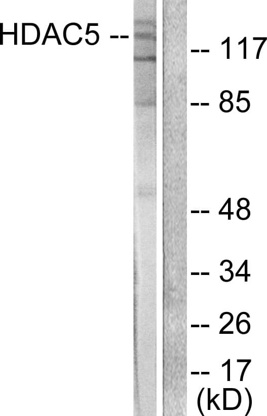 HDAC5 Antibody (aa1073-1122)