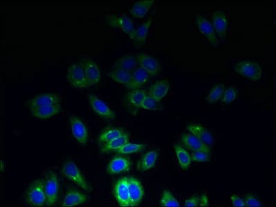Polyclonal Rabbit anti-Human TSPAN7 / CD231 Antibody (WB)