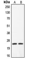 CLDN2 / Claudin 2 Antibody (C-Terminus)
