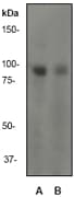Monoclonal Rabbit anti-Human GAB2 Antibody (clone EP369Y, Internal, WB)