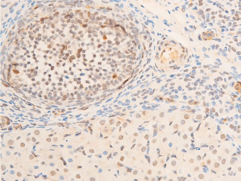 Polyclonal Rabbit anti-Human TK1 / TK / Thymidine Kinase Antibody (phospho-Ser13, IHC, IF, WB)
