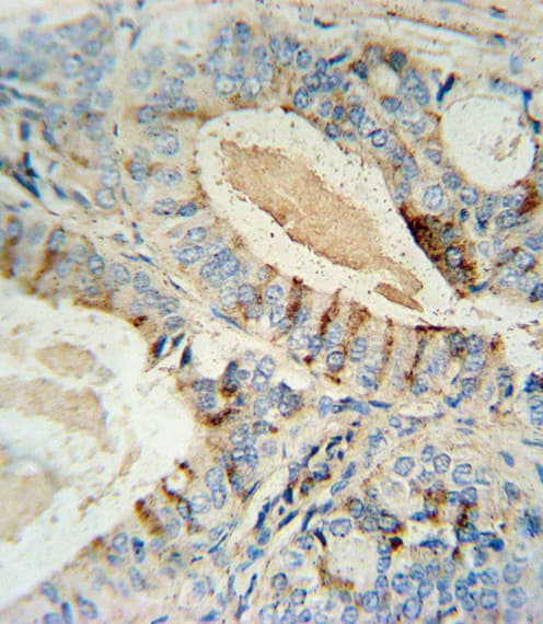 GCNT2 Antibody (aa364-391)