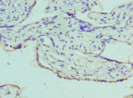 Polyclonal Rabbit anti-Human AZU1 / Azurocidin Antibody (aa27-251, IHC, WB)