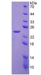 Human PCK2 / PEPCK Protein (Recombinant His-T7)