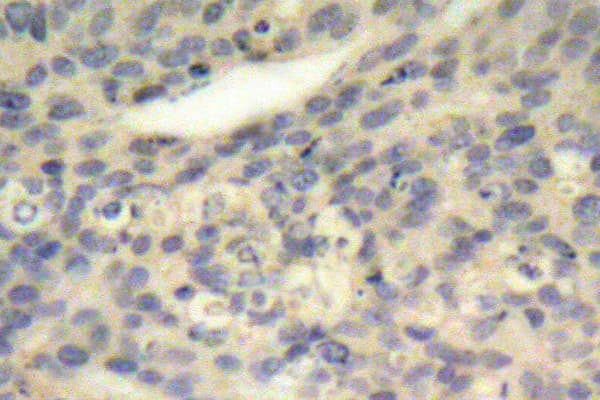 LIMK1 / LIMK Antibody (phospho-Thr508)
