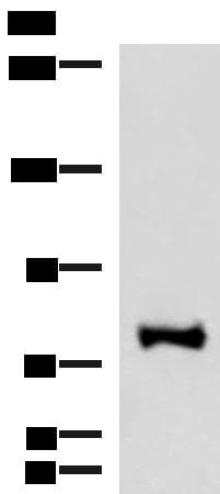 Polyclonal Rabbit anti-Human FOXK2 / ILF Antibody (IHC, WB)