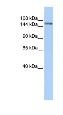 SYMPK / Symplekin Antibody (aa180-229)