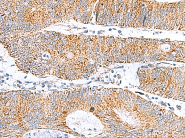 GCSH Antibody