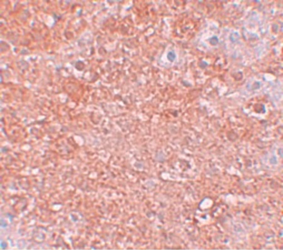 SLC39A12 / ZIP12 Antibody