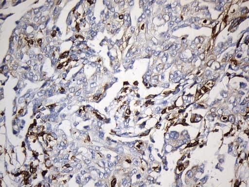 Monoclonal Mouse anti-Human CD74 / CLIP Antibody (clone UMAB232, IHC, WB)